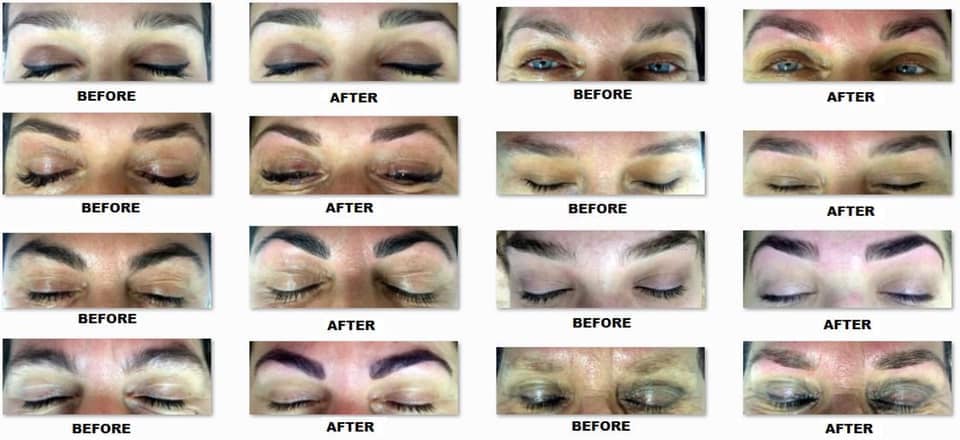 Images Estética Miss Pia