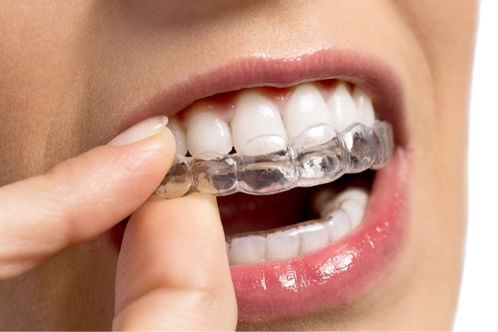 Dynamic Dental Group patient consultation with Invisalign in Vandalia, IL 