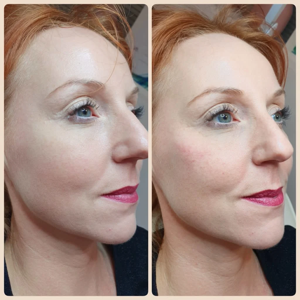 Images Lincoln Aesthetic