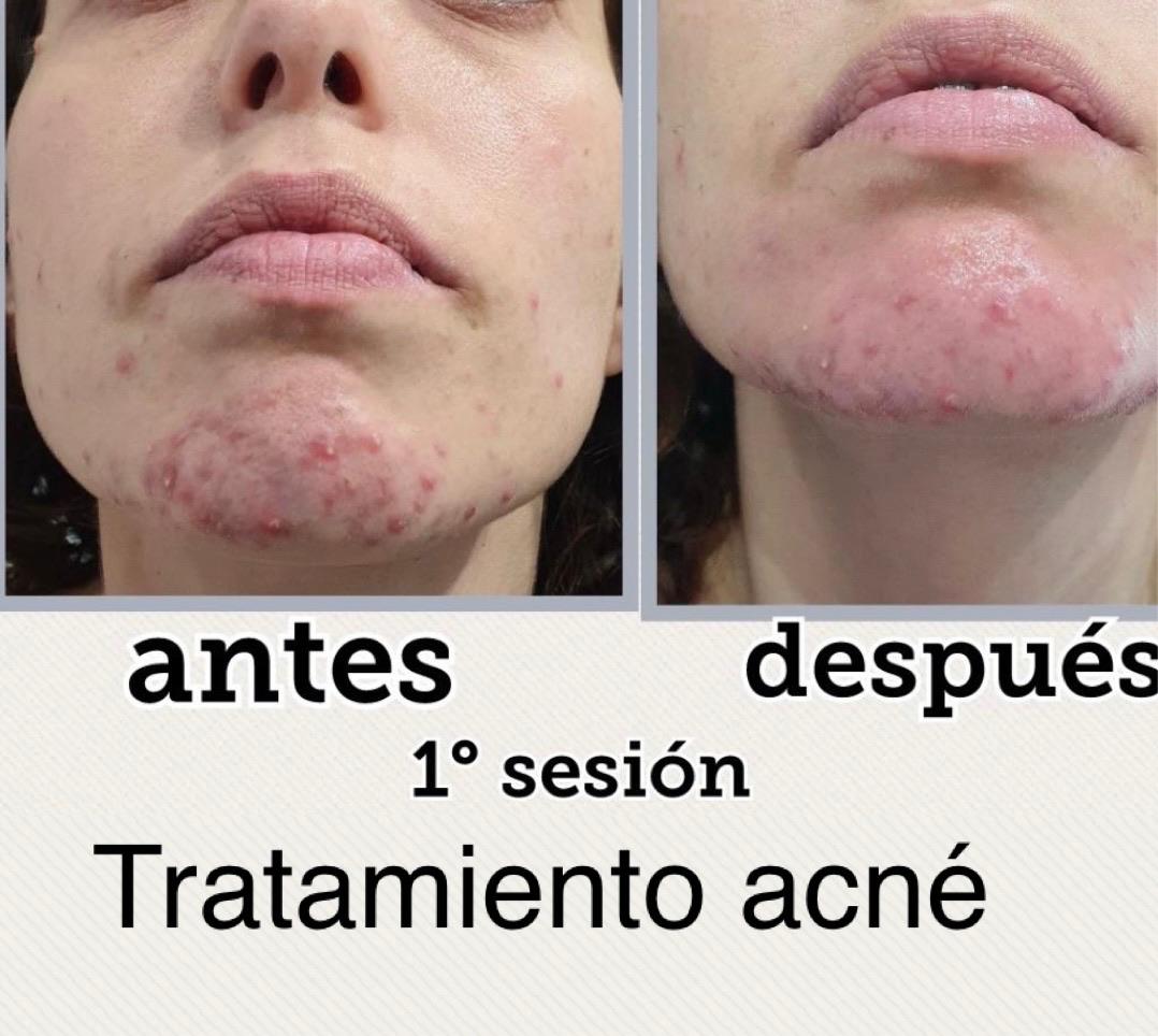 Images Centro De Estética Avanzada Y Láser Verónica Vico