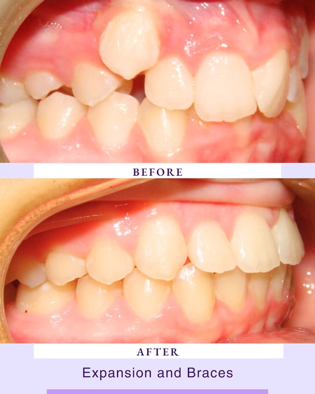 Images Above & Beyond Orthodontics