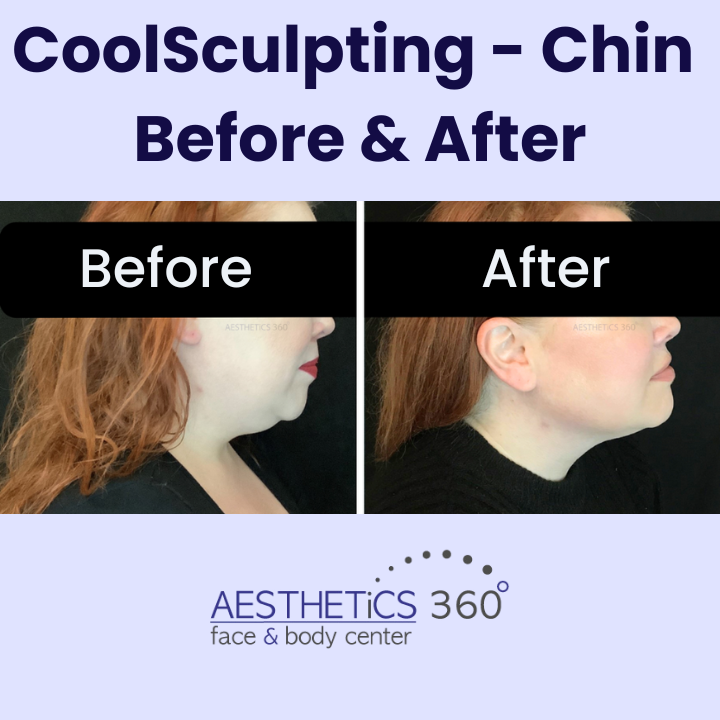 Images AESTHETICS 360° Face & Body Center