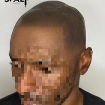 Images The Scalp Master