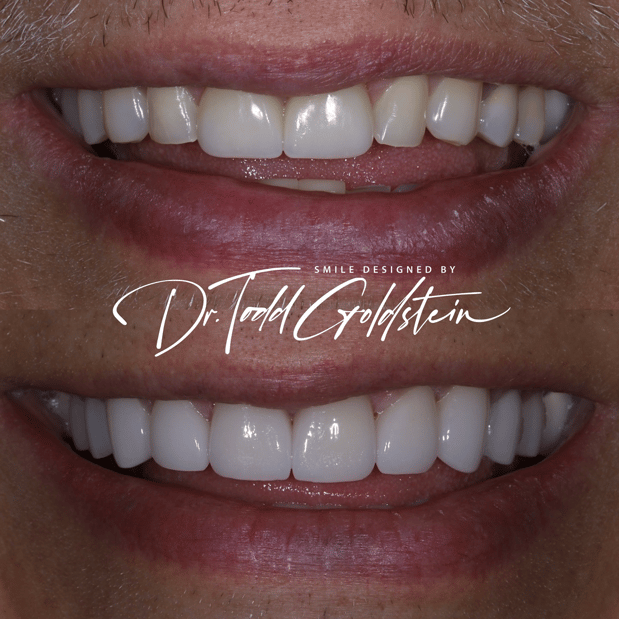 Images The Smile Aesthetic