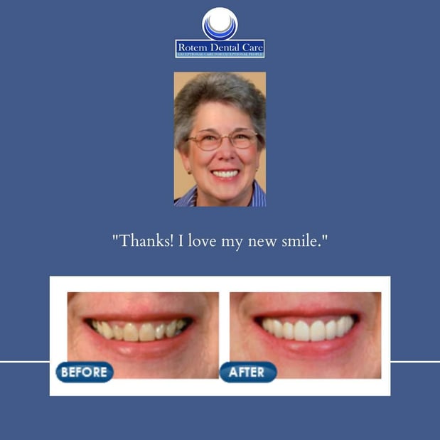 Images Rotem Dental Care