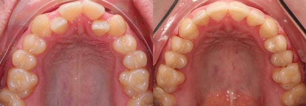 Images TLC Pediatric Dentistry and Orthodontics