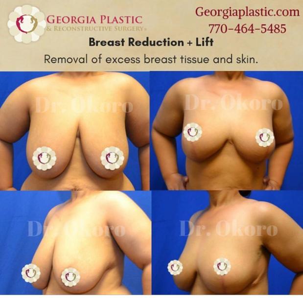 Images Georgia Plastic & Reconstructive Surgery