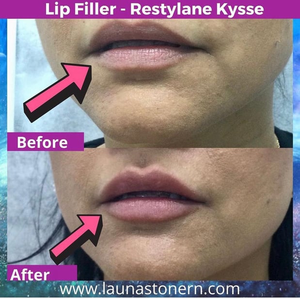 Images Launa Stone, R.N.