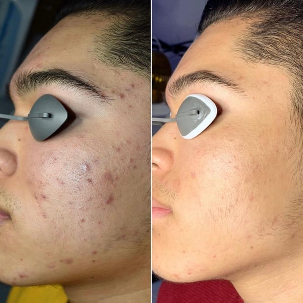 Images Face of Jules