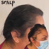 Images The Scalp Master