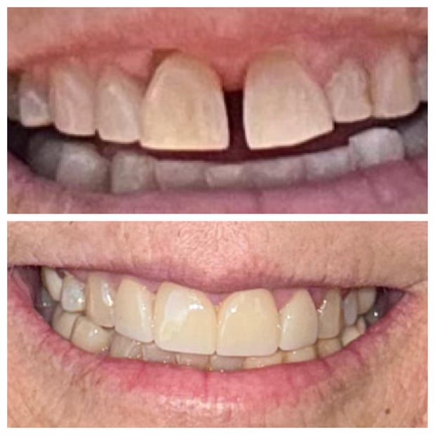 Images Summerlin Dental Solutions