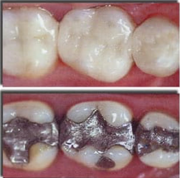 Images Northeast Lincoln Family Dentistry