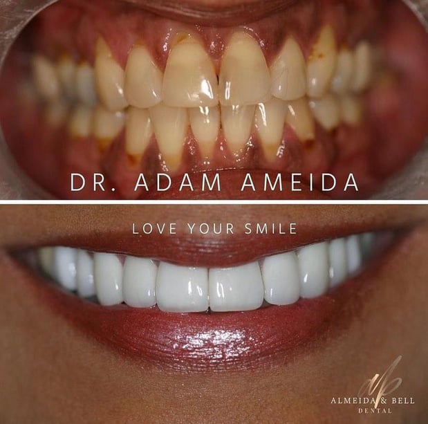 Images Almeida & Bell Dental Lone Tree - General, Cosmetic, and Implant Dentistry