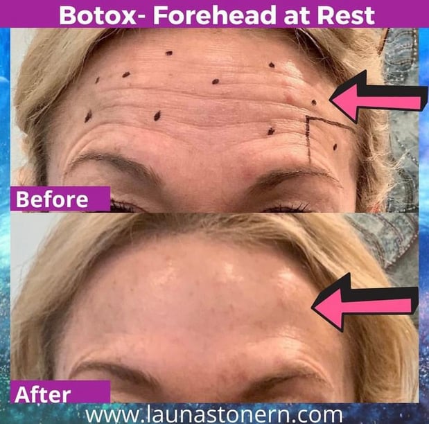 Images Launa Stone, R.N.