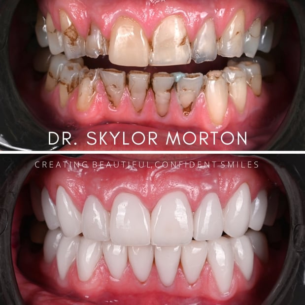 Images Nashville Wisdom Teeth and Implant Solutions
