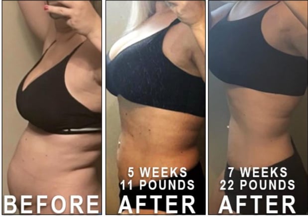 Images Renew Body Contouring & MedSpa