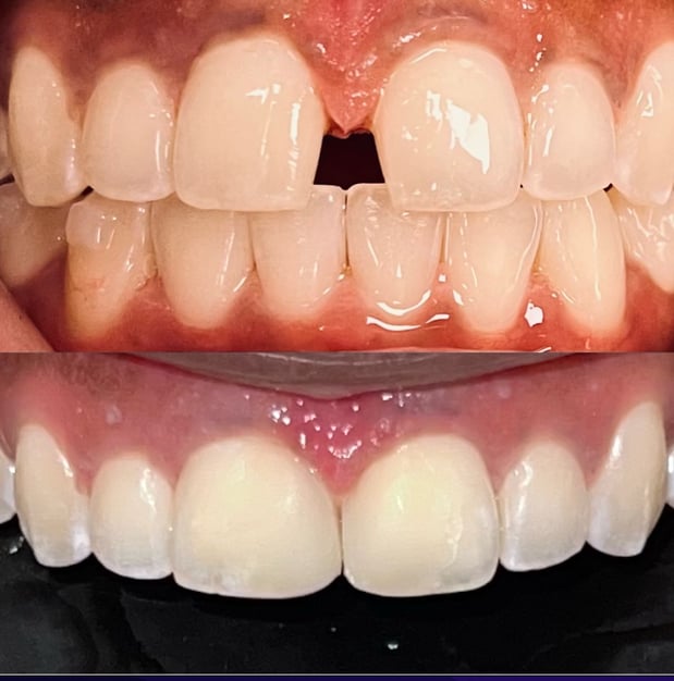 Images SouthPointe Dental