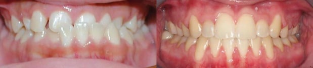 Images TLC Pediatric Dentistry and Orthodontics