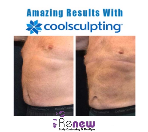 Images Renew Body Contouring & MedSpa