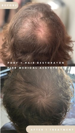 Images Pier Aesthetics: Douglas Mest, MD