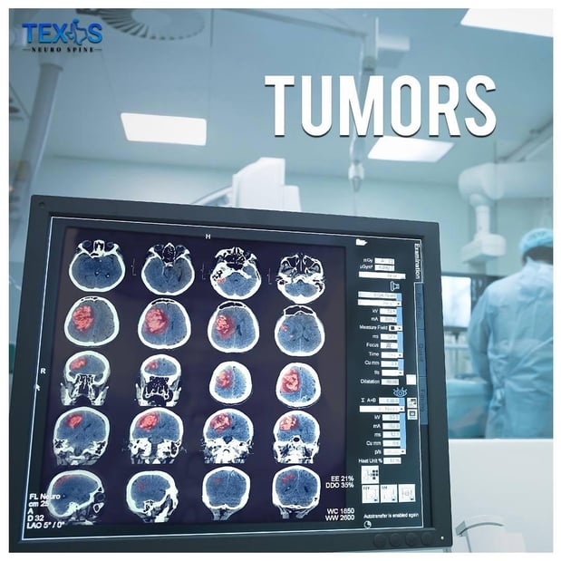 Images Texas Neuro Spine, Office of Dr. Michelle Cecchini