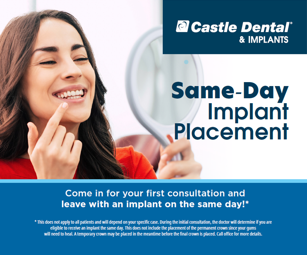 Book your FREE implant consult and see if you can receive an implant on the same day!