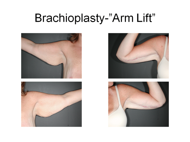 Images Dr. Joseph T. Chun, MD