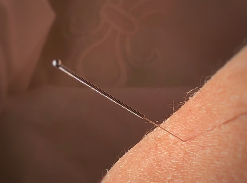 Images Durango Acupuncture