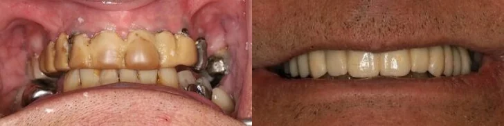 Images Iroquois Dentistry