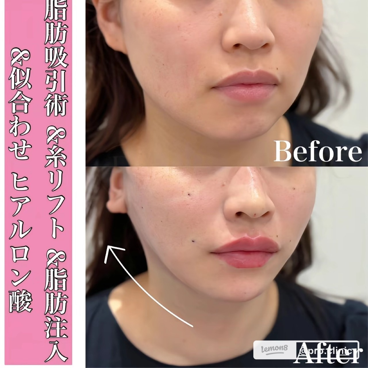 Images プロクリニック