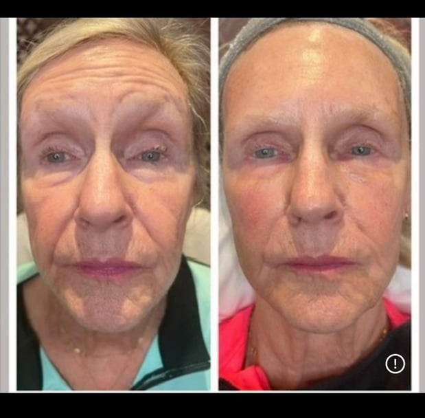 Images Body Lounge Park Cities - Whole Body Wellness & Medical Aesthetics, Dallas, TX