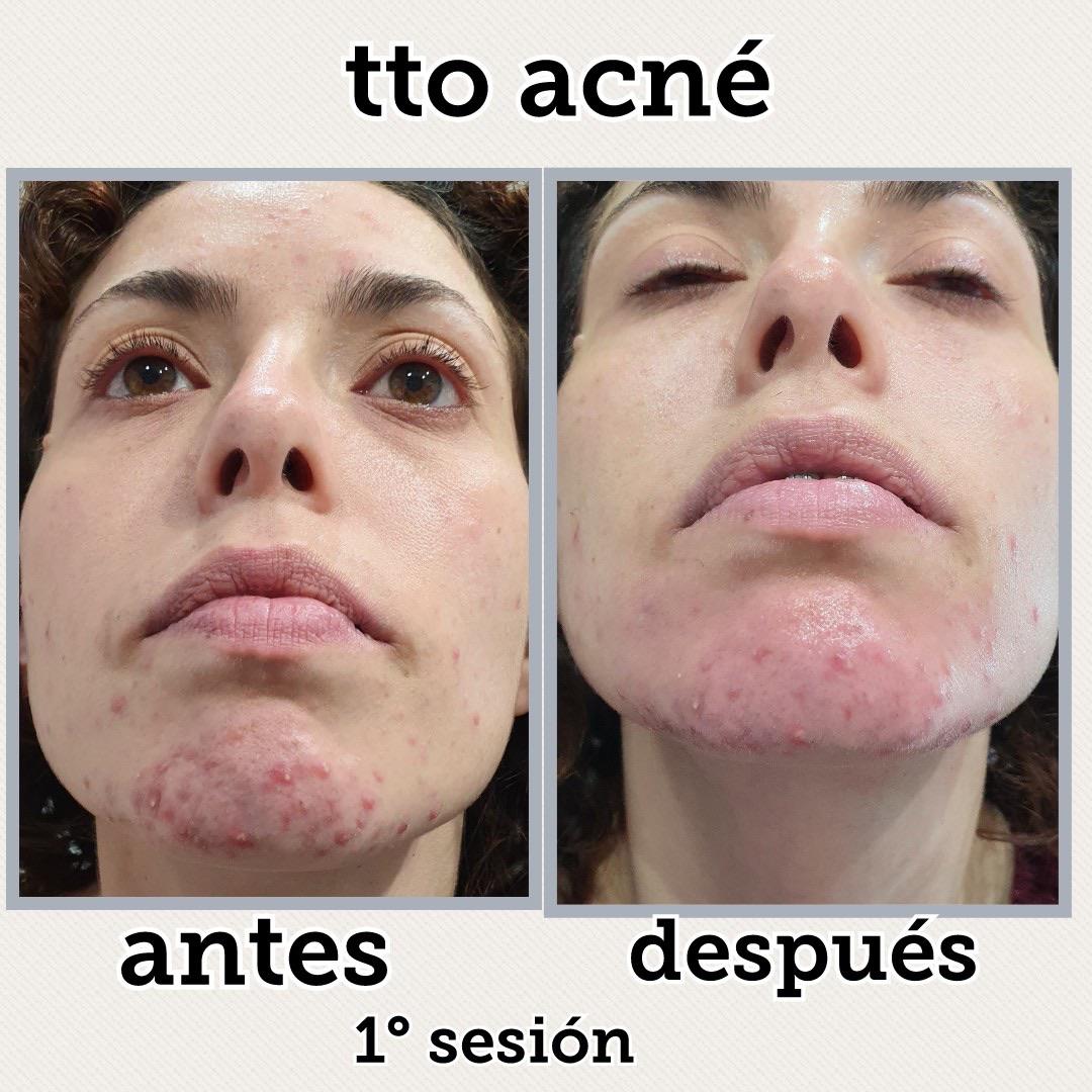 Images Centro De Estética Avanzada Y Láser Verónica Vico
