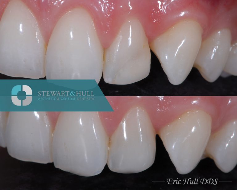 Images Eric Hull DDS Aesthetic & General Dentistry