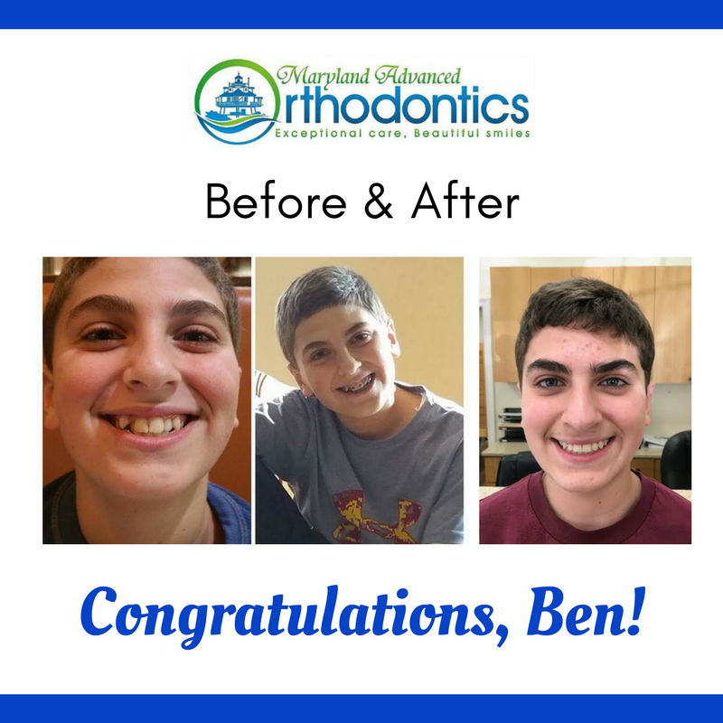 Images Maryland Advanced Orthodontics: David S. Lavine, DDS, MS