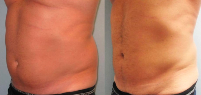 Images Finesse Cosmetic Surgery