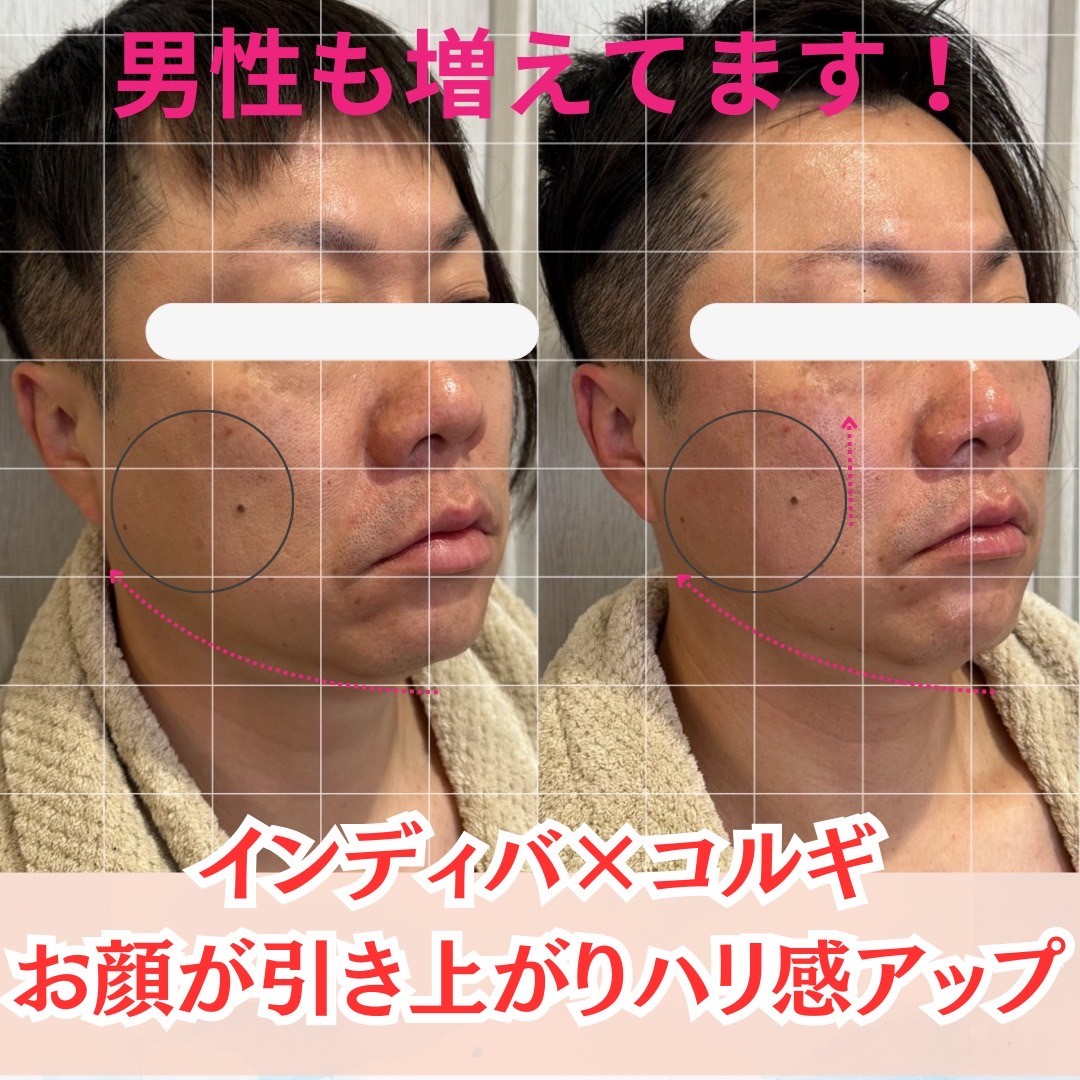 Images アディス リティフル