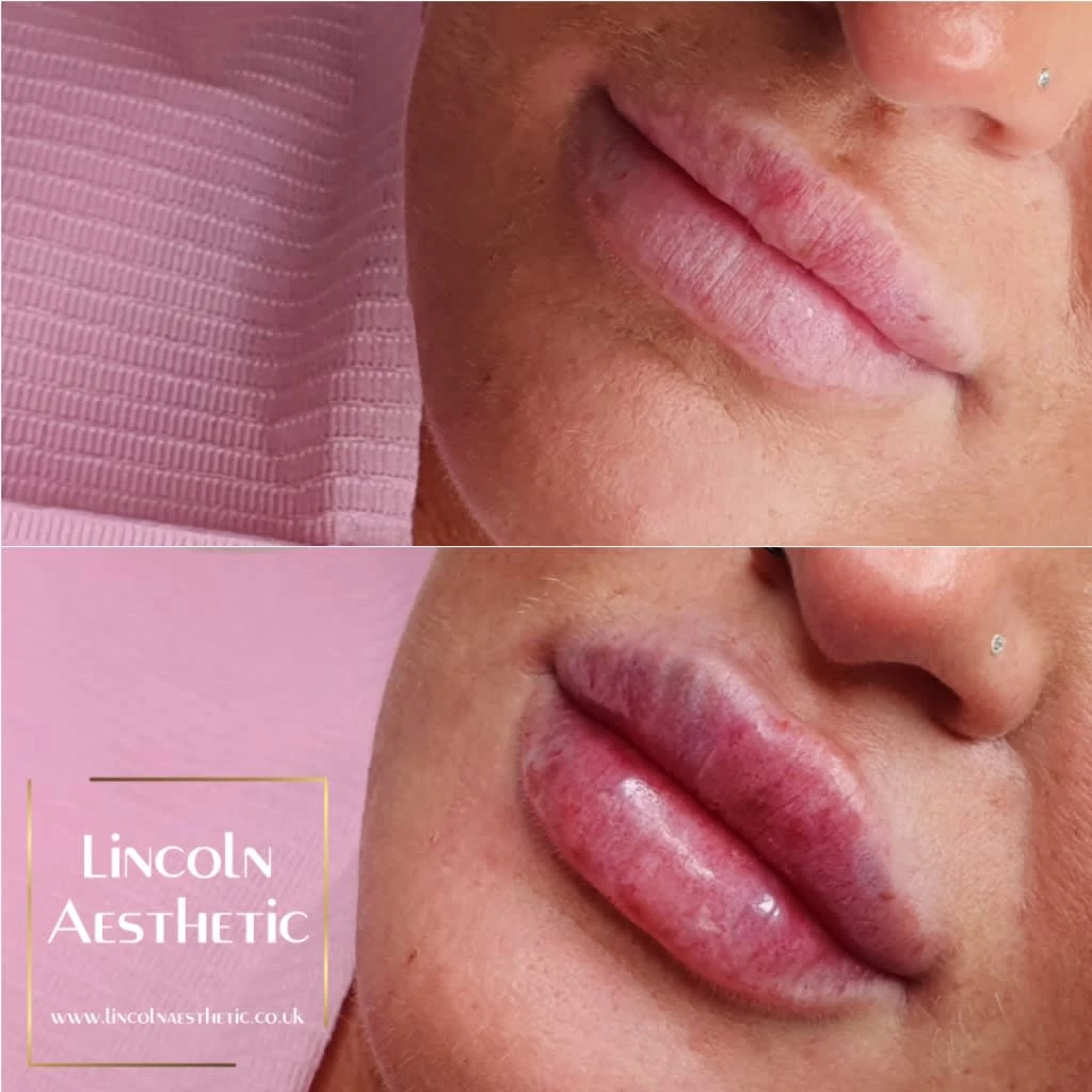 Images Lincoln Aesthetic