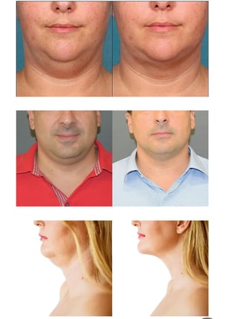 Images ProSculpt Med Spa