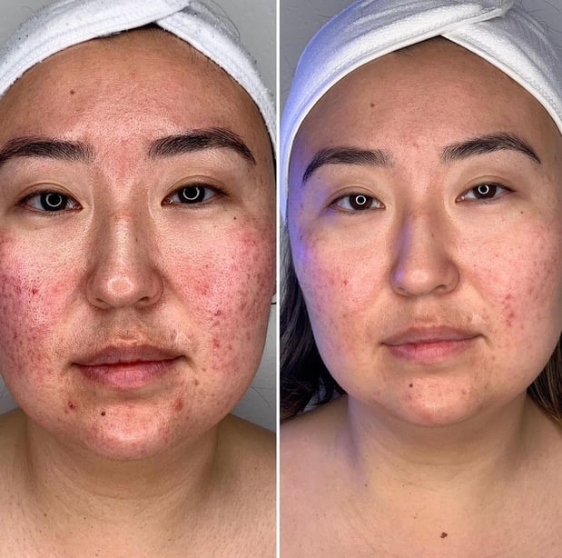 Images Face of Jules