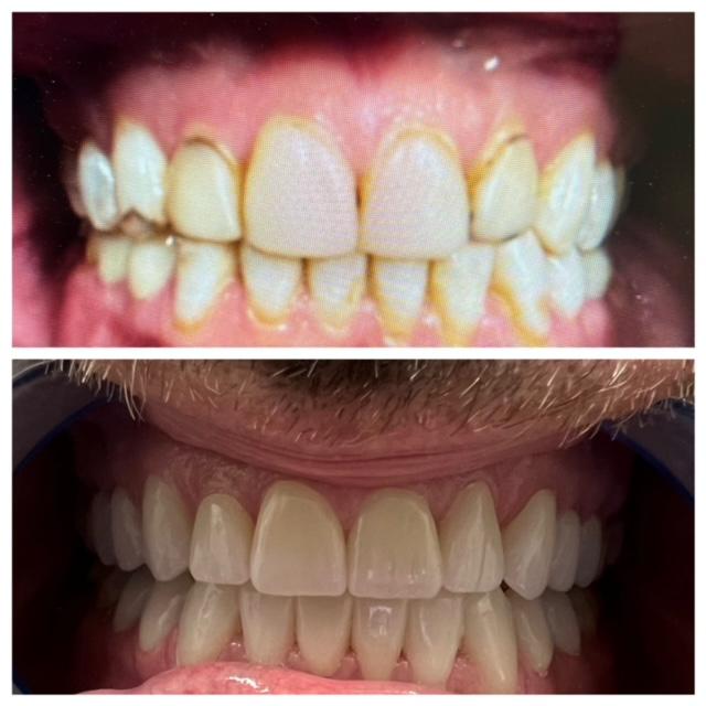 Images Best Dental - Family & Orthodontics