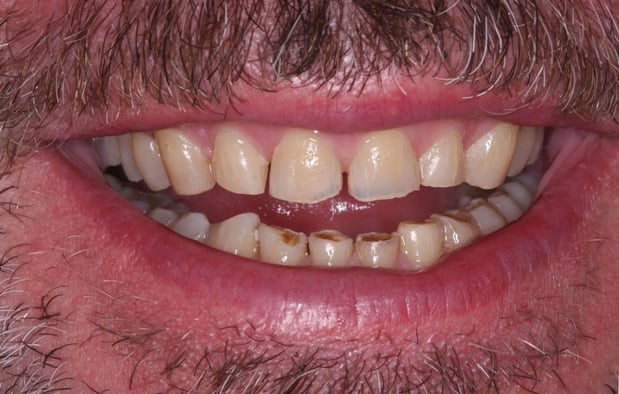 Images SmileCare Dental