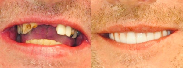 Images Riverside Family Dental