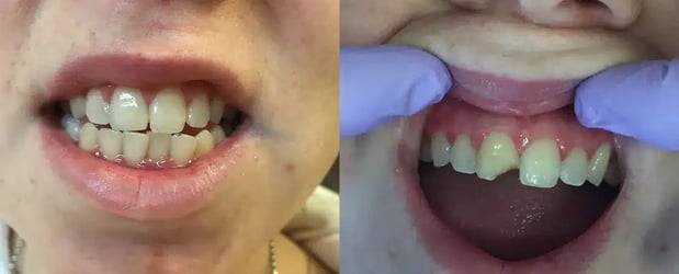 Images Twin Branch Dental