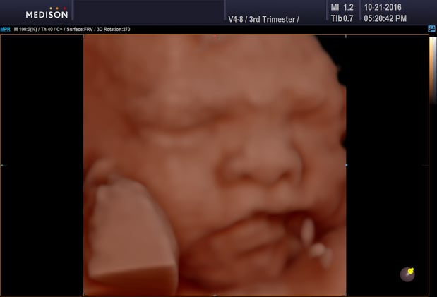 Images Heavenly 3D 4D Ultrasounds