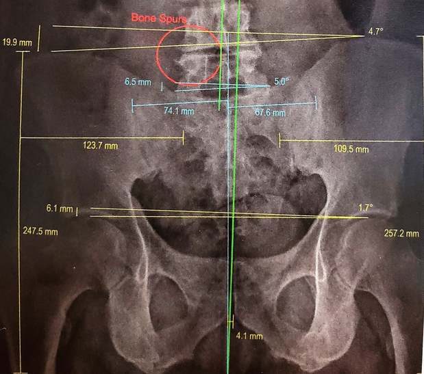 Images Richard G. Nassab, D.C. - Dublin Gonstead Chiropractor & Neuropathy Treatment Center
