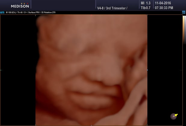 Images Heavenly 3D 4D Ultrasounds