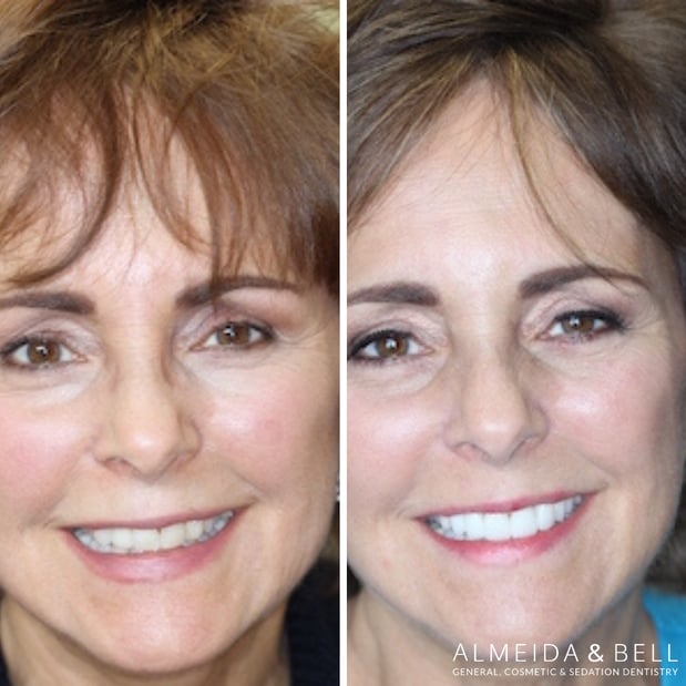 Images Almeida & Bell Dental Lone Tree - General, Cosmetic, and Implant Dentistry