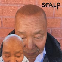 Images The Scalp Master