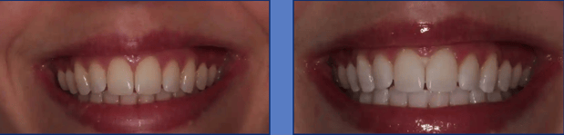 Images Preference Dental (Mecosta)