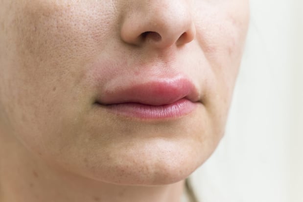 Images Gupta Allergy: Allergy & Asthma Specialists of Lansing, PLLC